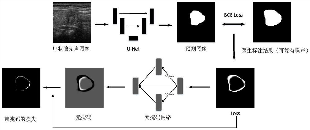 Metalearning-based thyroid ultrasound nodule fuzzy boundary-oriented segmentation method