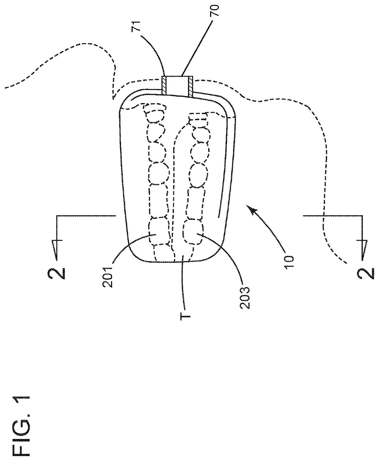 Hand-held mouthpiece for cooling of oral tissue of a user