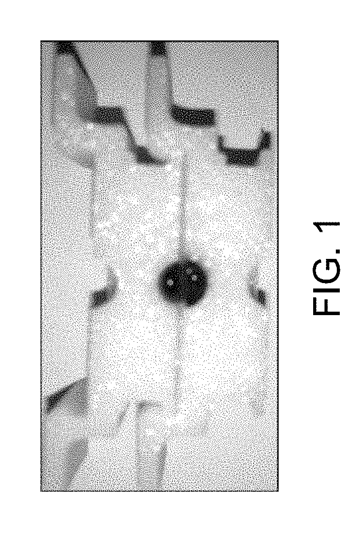 Device and methods of using device for detection of hyperammonemia