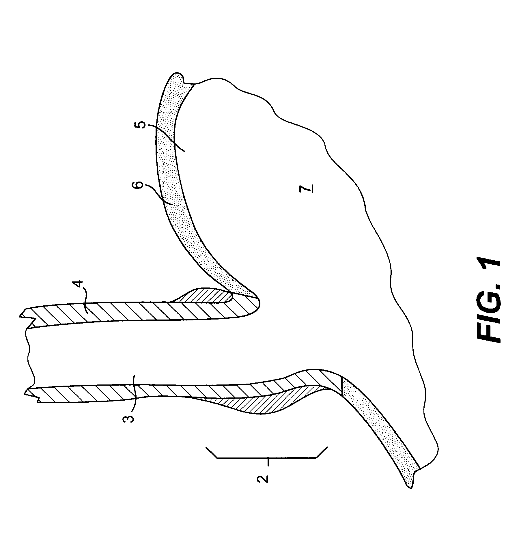 Devices and methods for fastening tissue layers