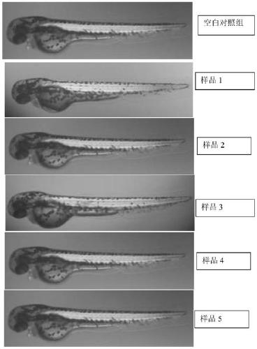 A kind of preparation technology and application of black garlic polysaccharide extract