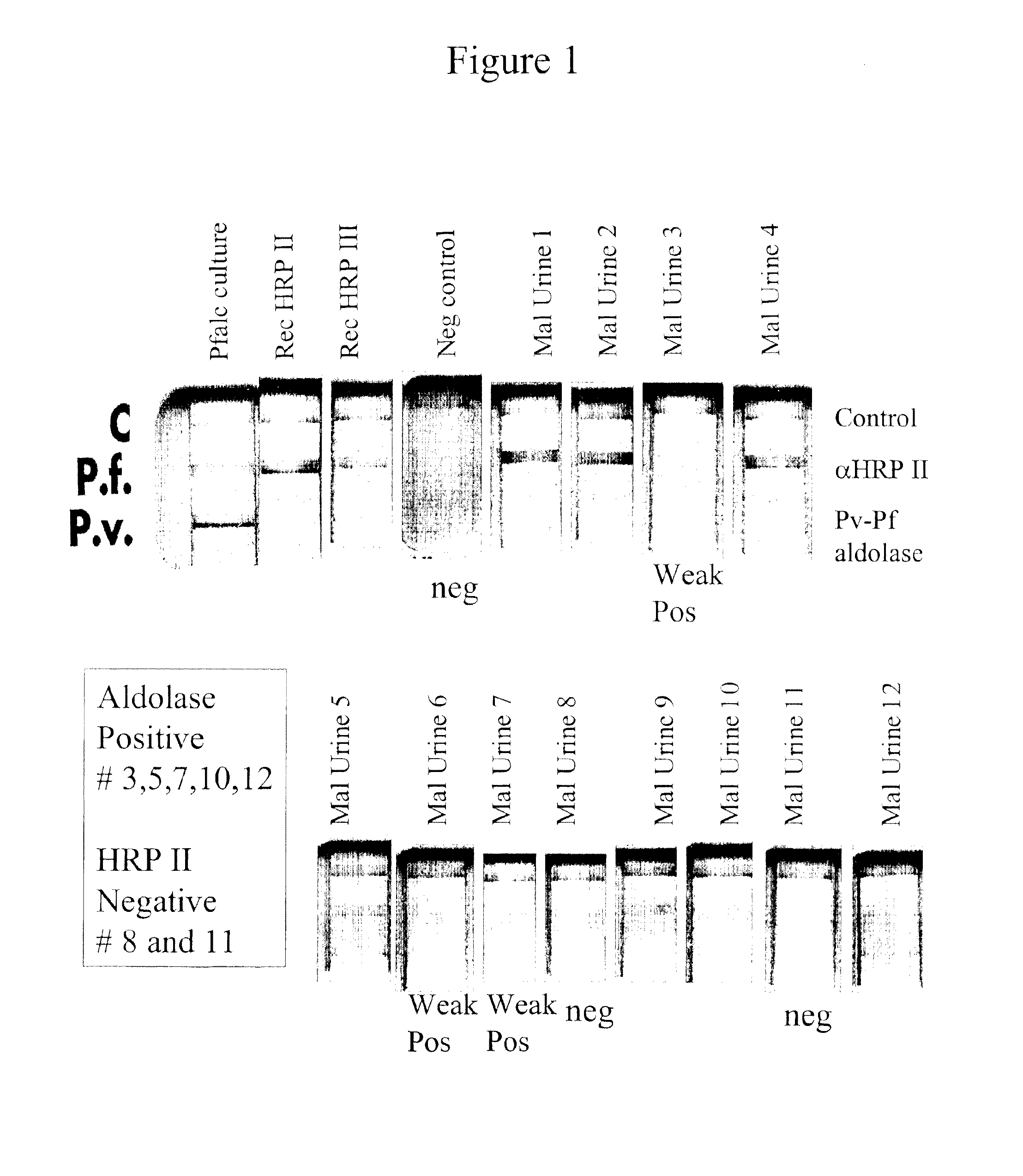 <i>Plasmodium </i>diagnostic assay device