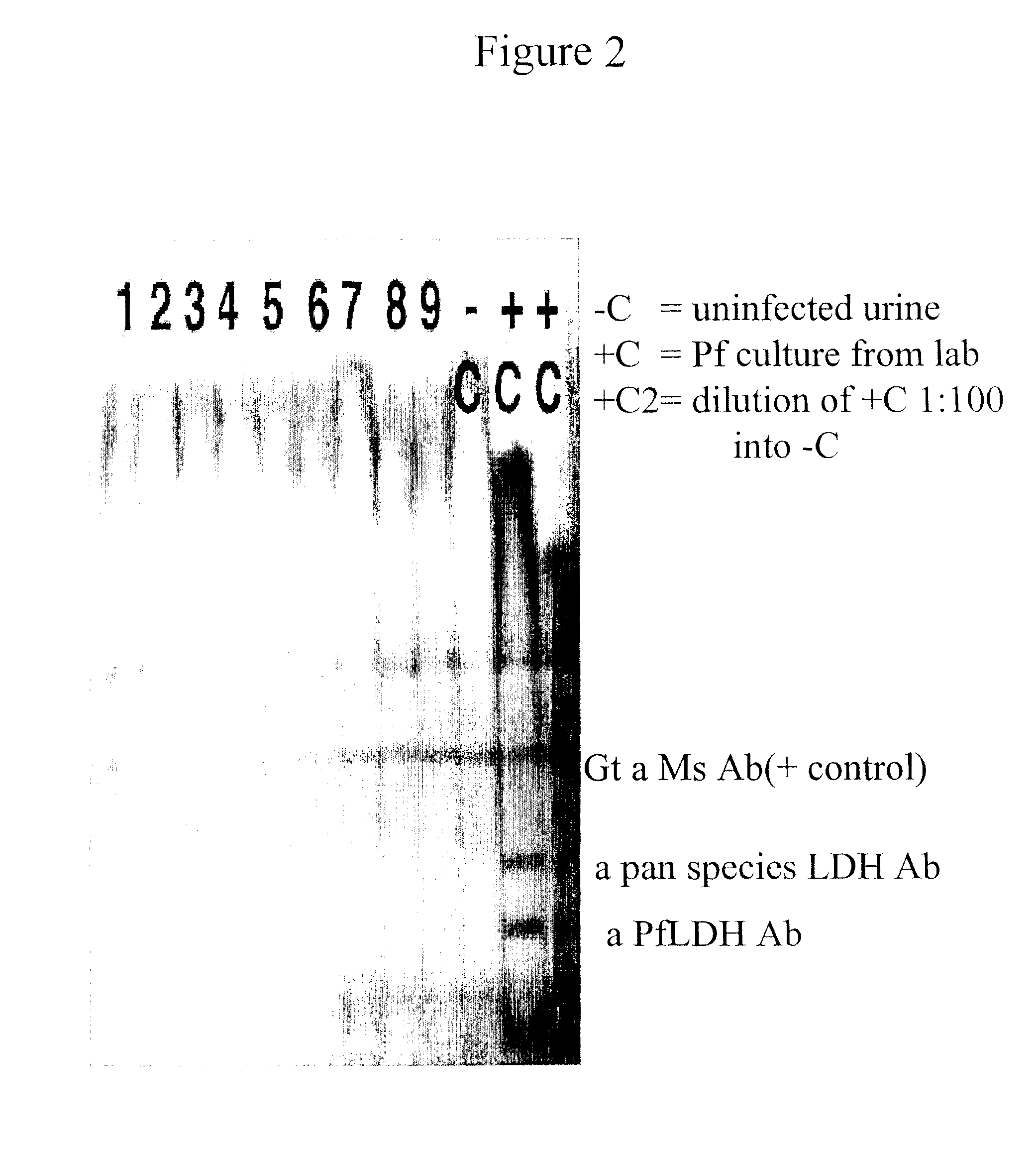 <i>Plasmodium </i>diagnostic assay device