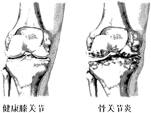 Application of chemical small molecule 4-aminobiphenyl in prevention and treatment of osteoarthritis