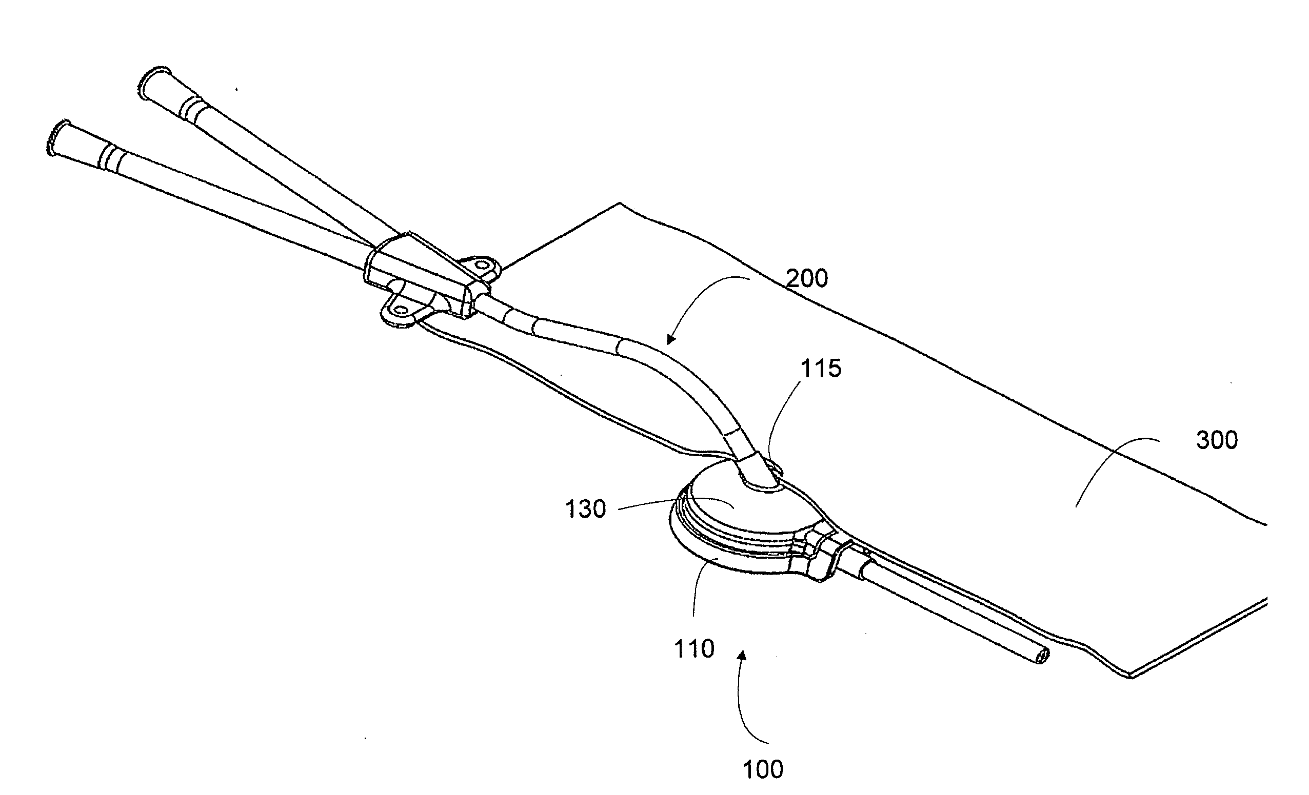 Deformable medical implant