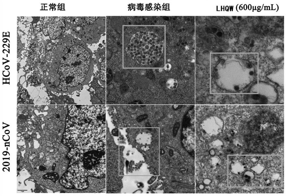 Application of traditional Chinese medicine composition in preparation of medicine for preventing and treating novel coronavirus infection pneumonia
