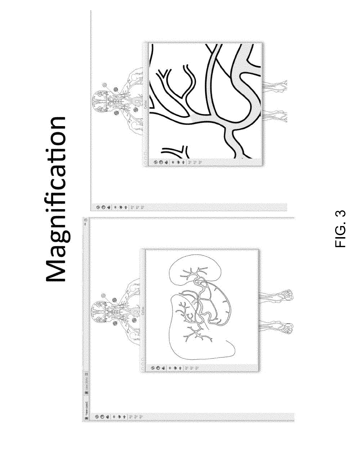 Automated medical procedure coding and documentation system