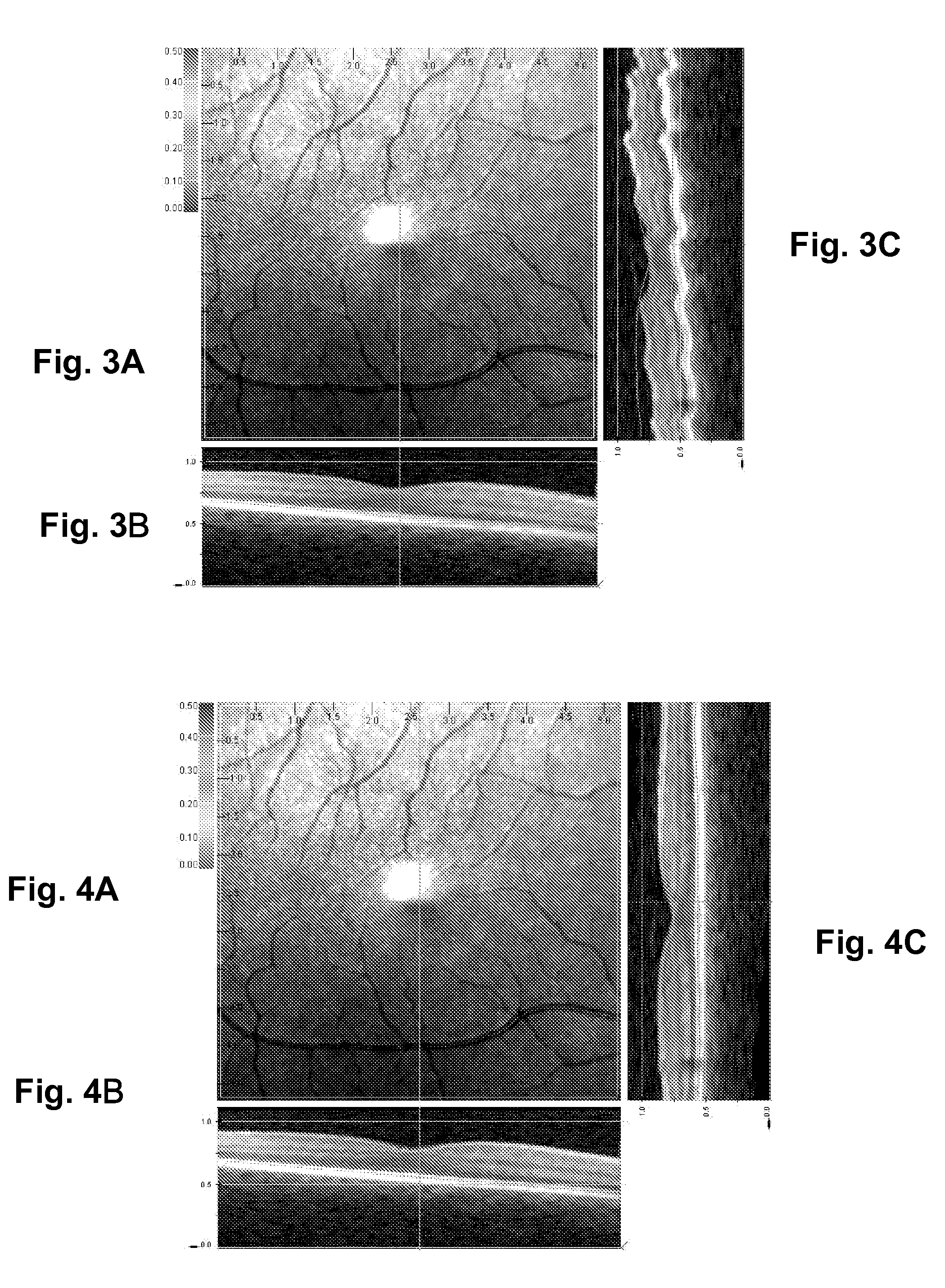 Method for correcting patient motion when obtaining retina volume using optical coherence tomography