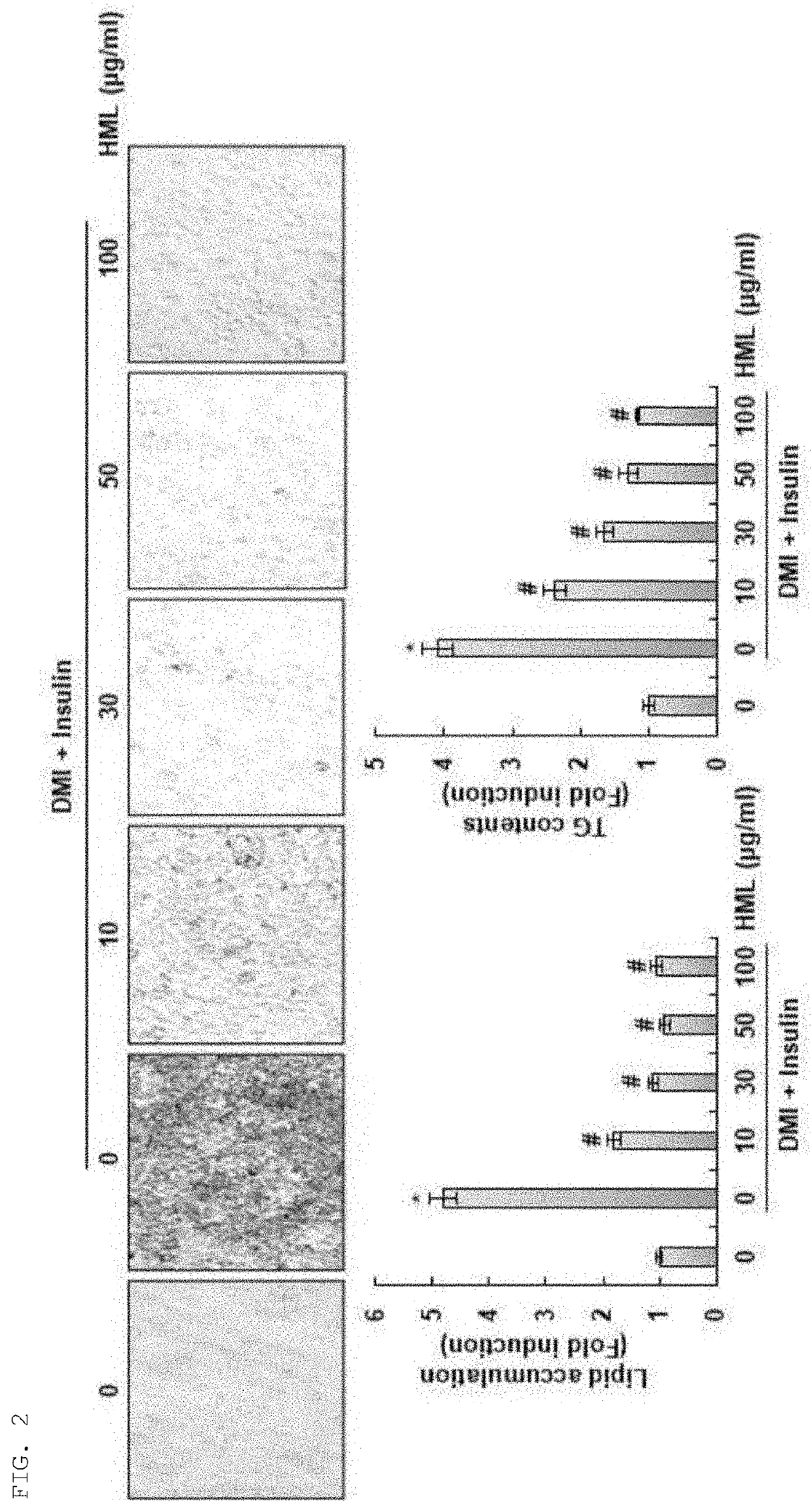 Anti-obesity composition including geumhwagyu extract as active ingredient