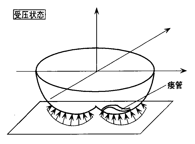 Measurement device and method of hip curved-surface shape and normal pressure distribution