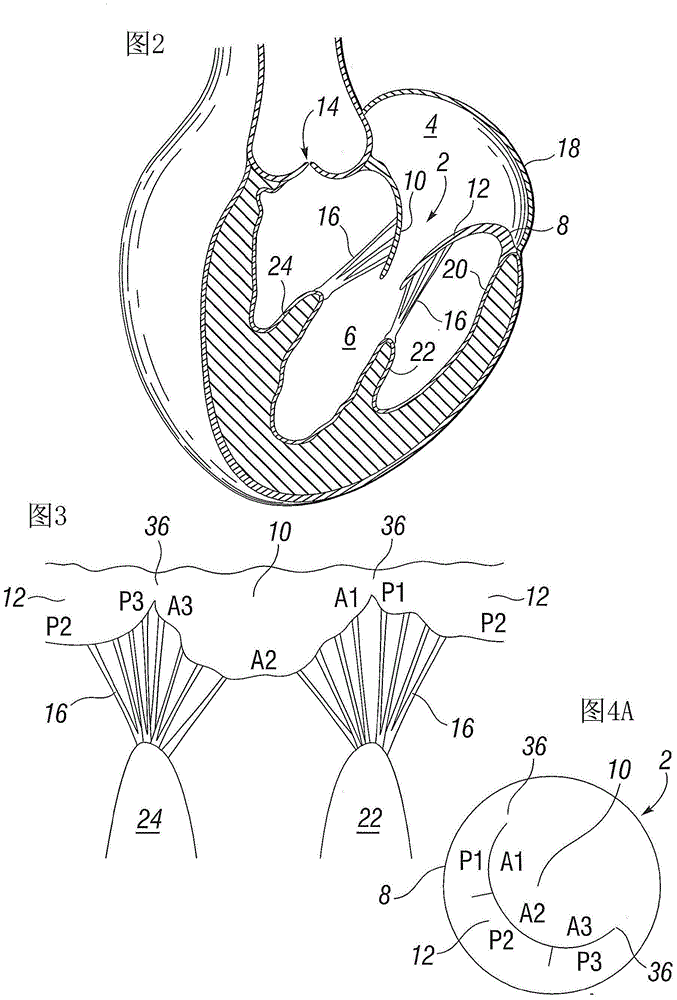 Prosthetic valve for mitral valve replacement