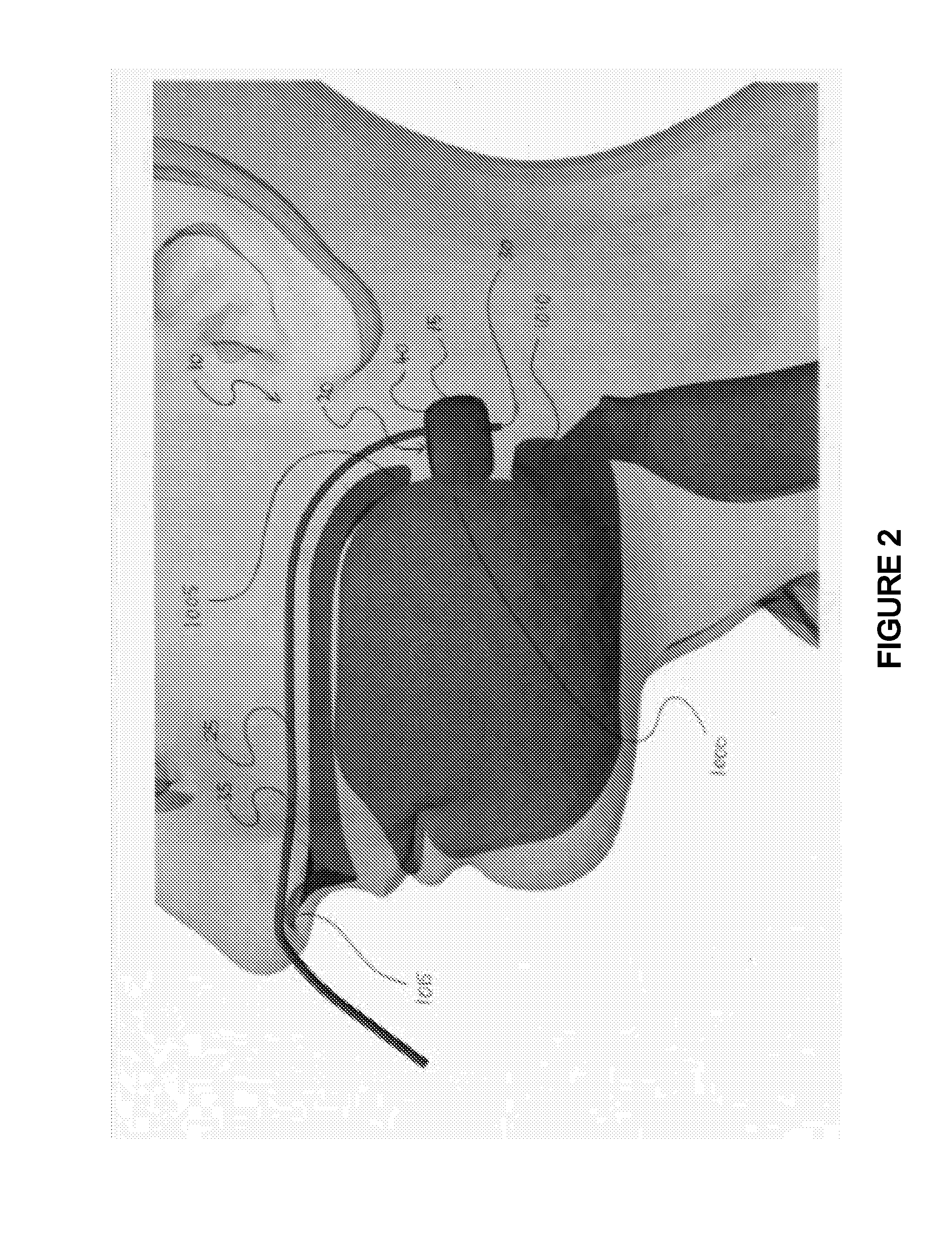 Devices for Maintaining An Oropharyngeal Airway, Methods of Creating An Oropharyngeal Airway and Systems for Mainitaining An Oropharyngeal Airway
