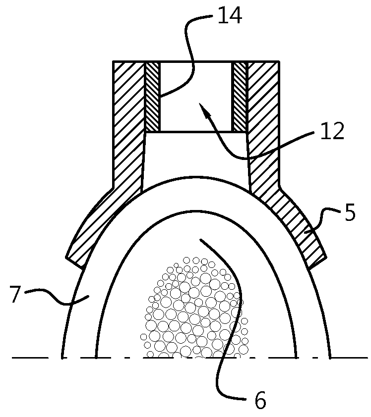 Force-closure or form-closure positioning of surgical templates for guided implant dentistry