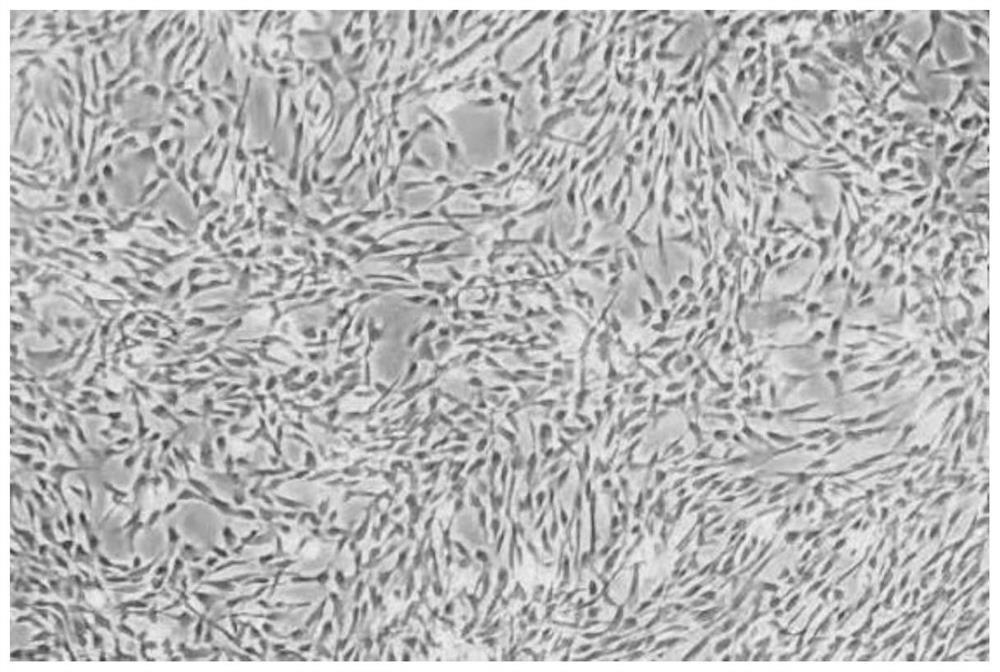 A kind of autologous umbilical cord mesenchymal stem cell cryopreservation liquid and its preparation and cryopreservation method