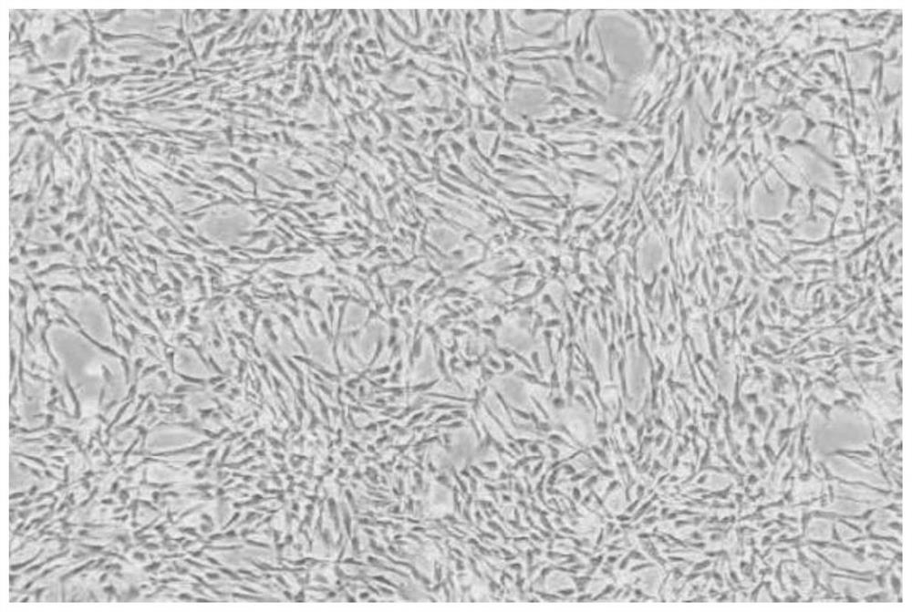A kind of autologous umbilical cord mesenchymal stem cell cryopreservation liquid and its preparation and cryopreservation method
