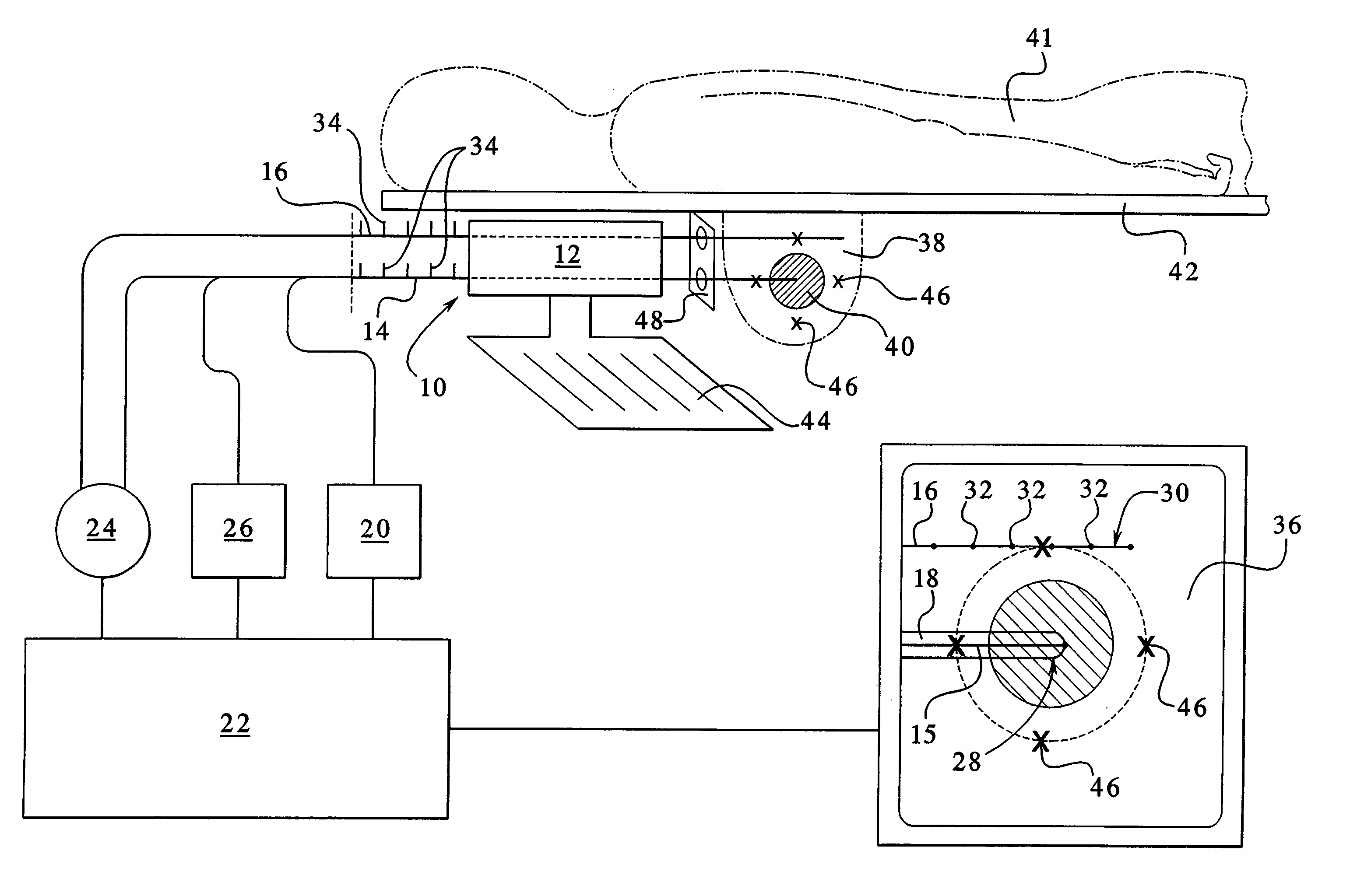 Apparatus and method for delivering ablative laser energy and determining the volume of tumor mass destroyed