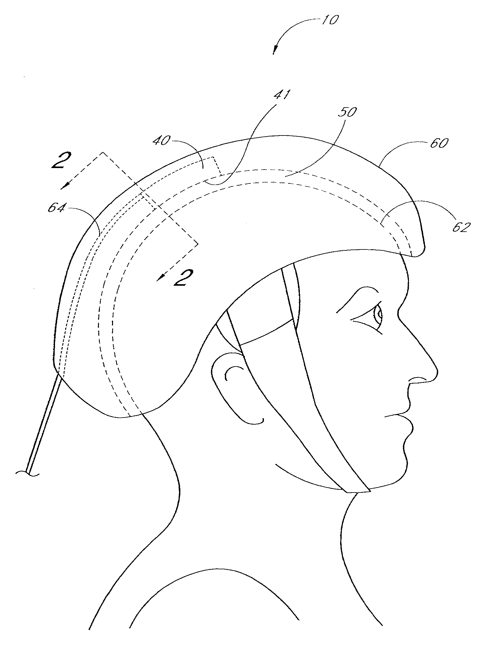 Method of treatment of neurological injury or cancer by administration of dichloroacetate