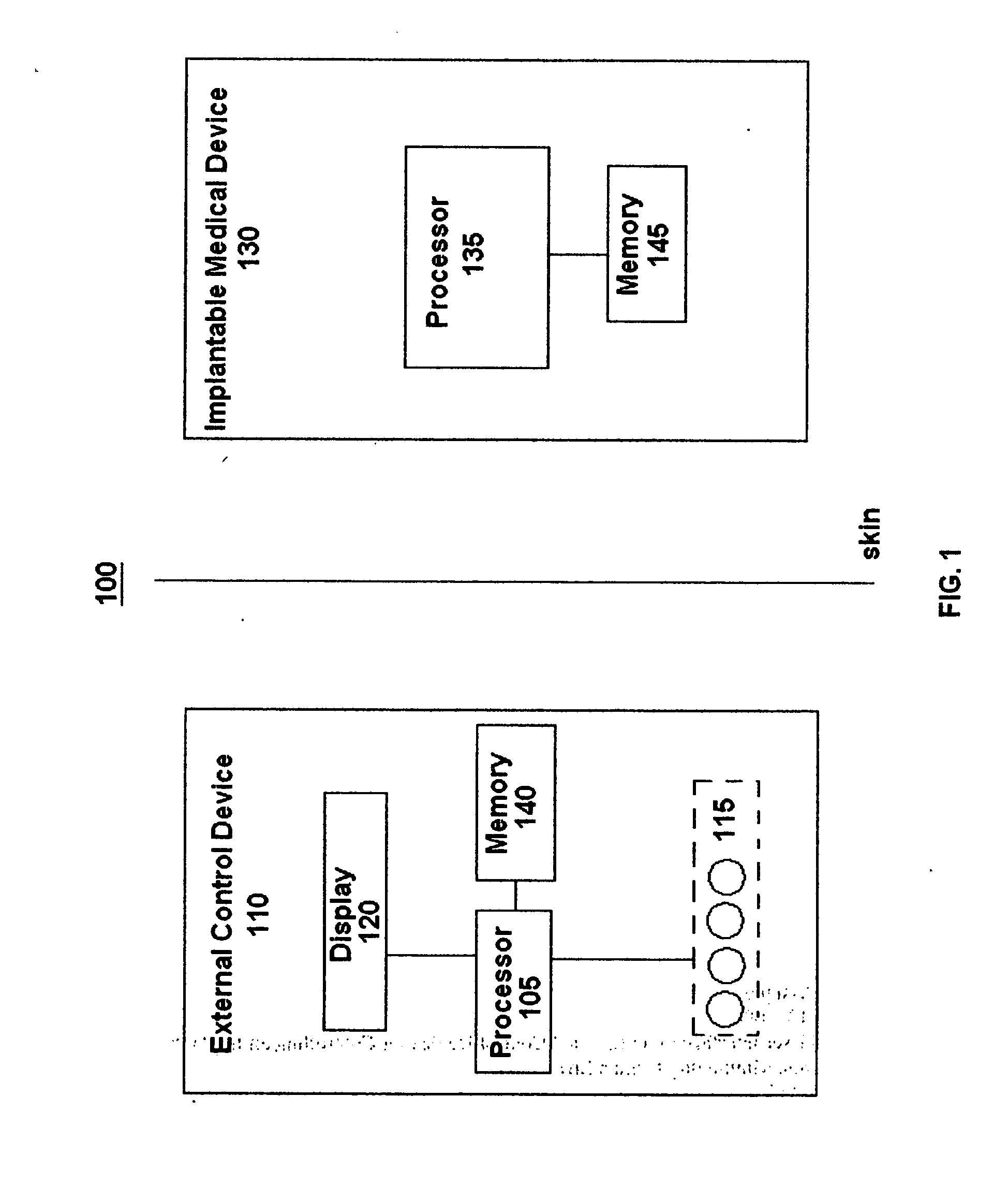 Graphical user interface of an external control device for controlling an implantable medical device while minimizing human error