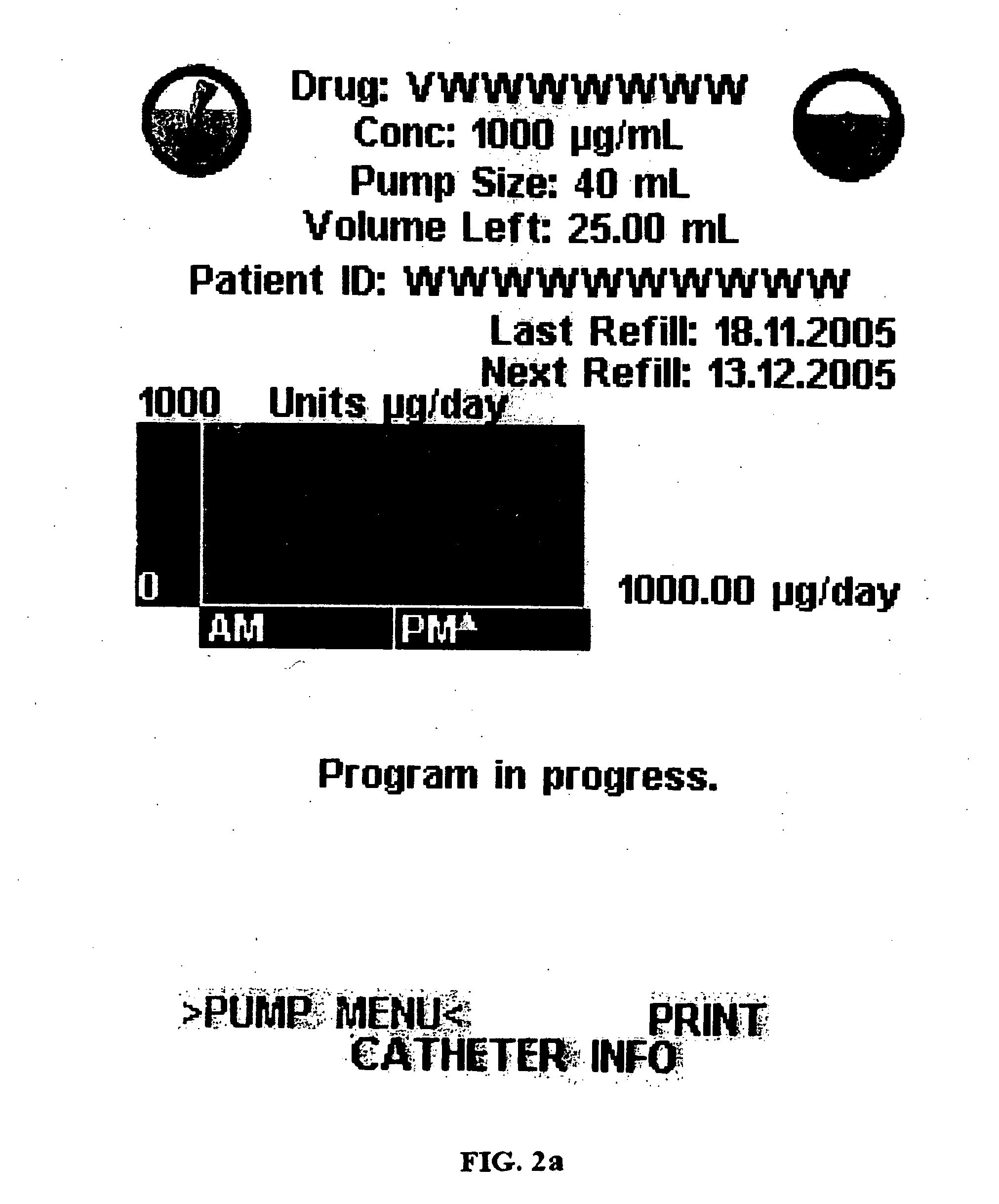 Graphical user interface of an external control device for controlling an implantable medical device while minimizing human error