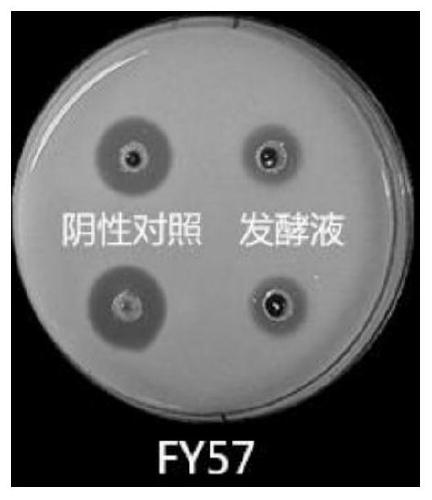 Anti-Streptomyces fy57 and its application in the preparation of trypsin inhibitors