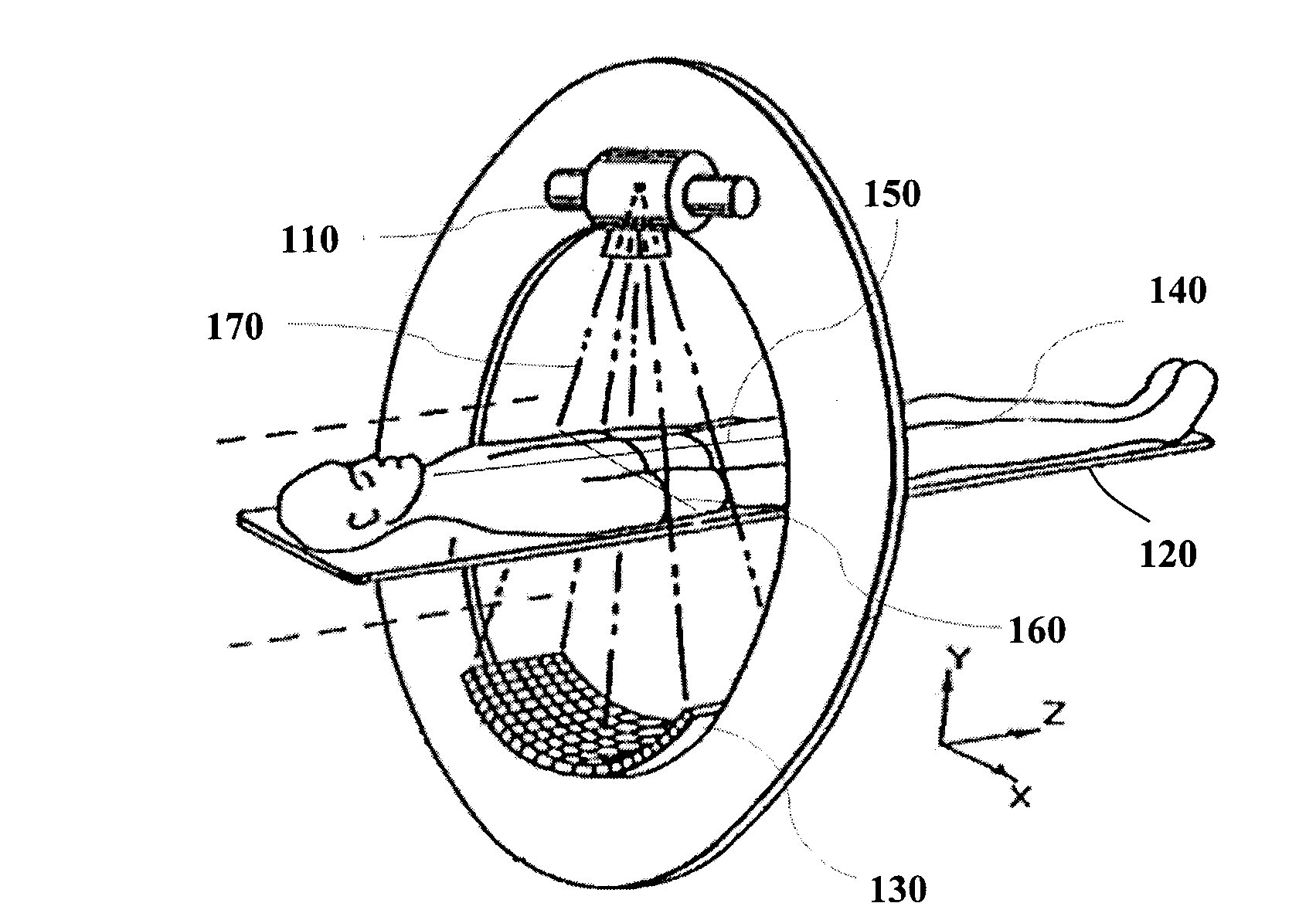 Body laser positioning system and method used for computed tomography (CT) system