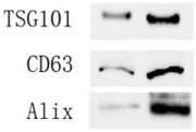 Kidney-targeted drug-loaded exosome, application and medicine for treating kidney diseases