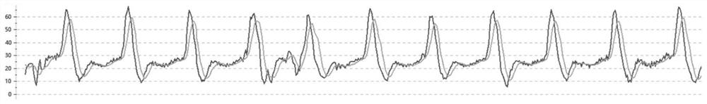 Pulse measurement method and device, terminal device, and readable storage medium