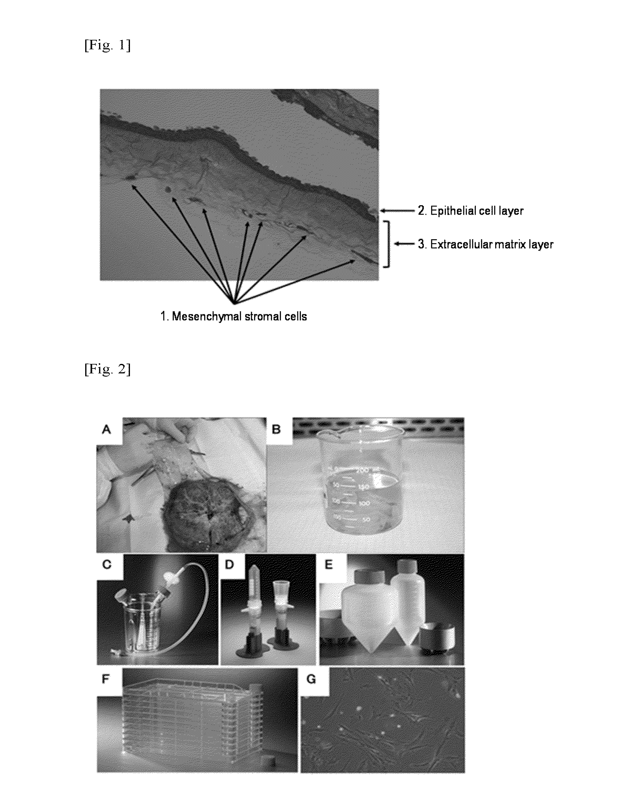 Method for producing amniotic mesenchymal stromal cell composition, method for cryopreserving the same, and therapeutic agent