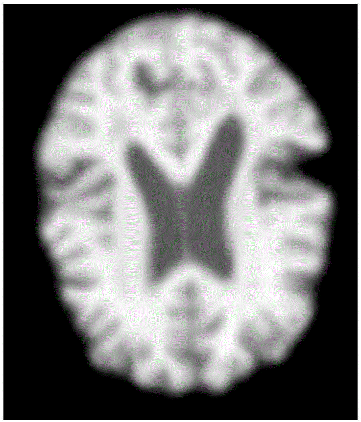Head MRI image skull peeling module