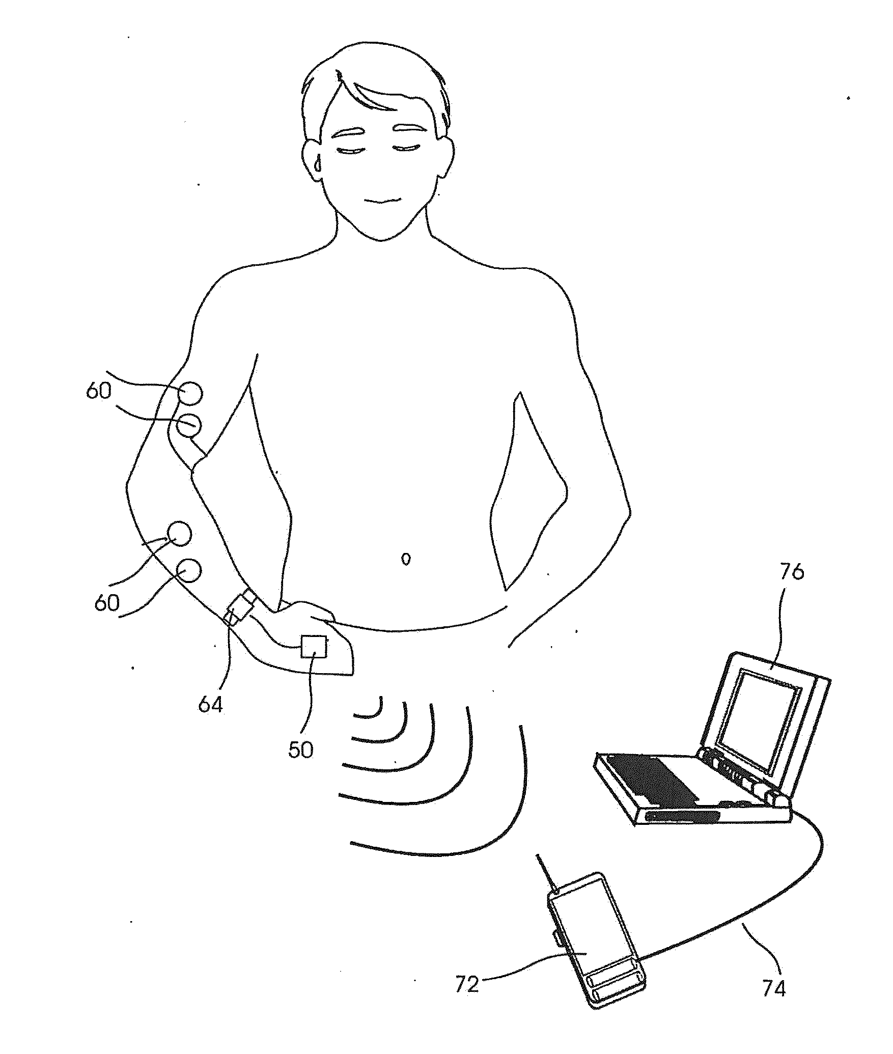 Movement disorder monitoring and symptom quantification system and method