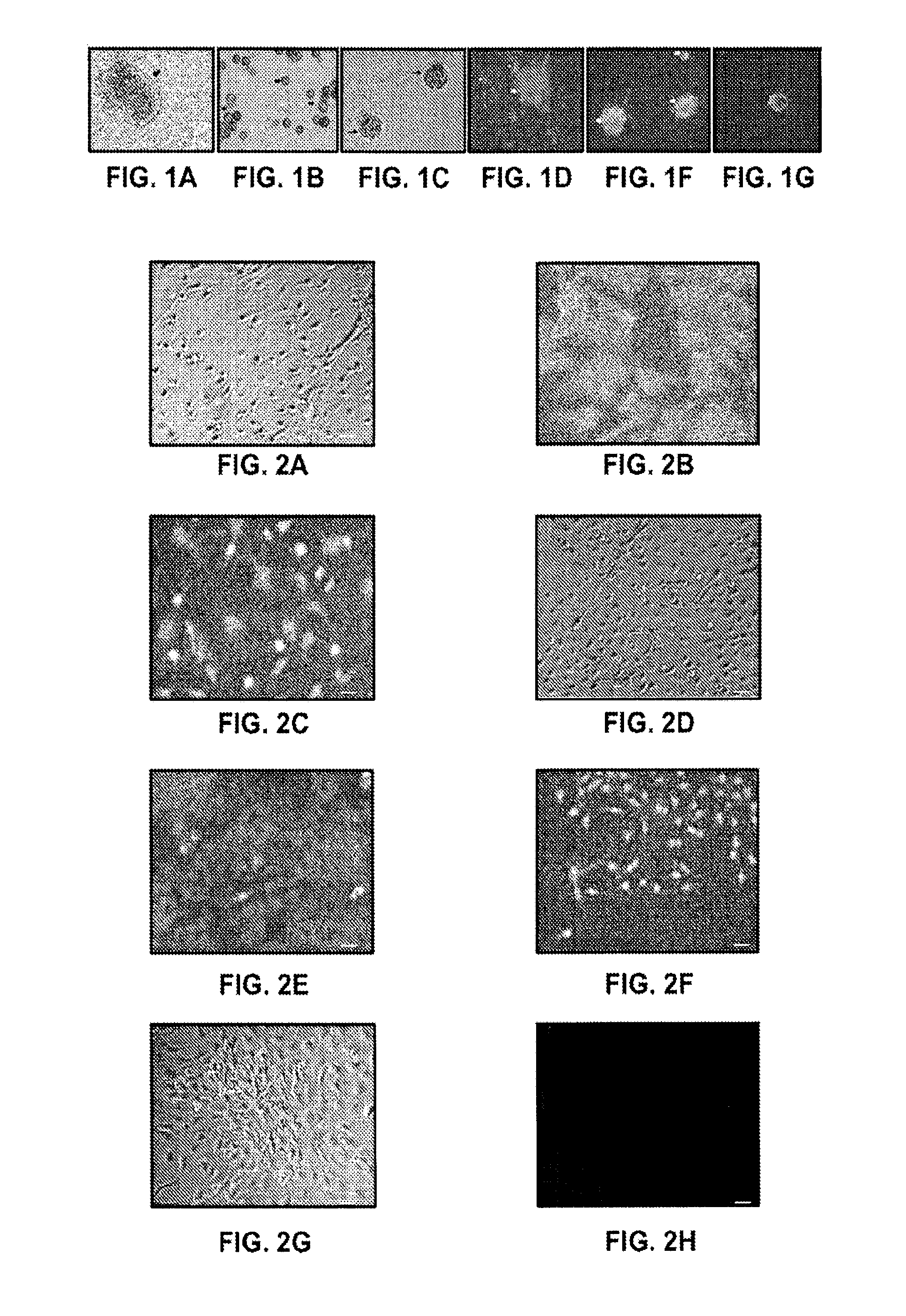 Endorphin Therapy Compositions and Methods of Use Thereof