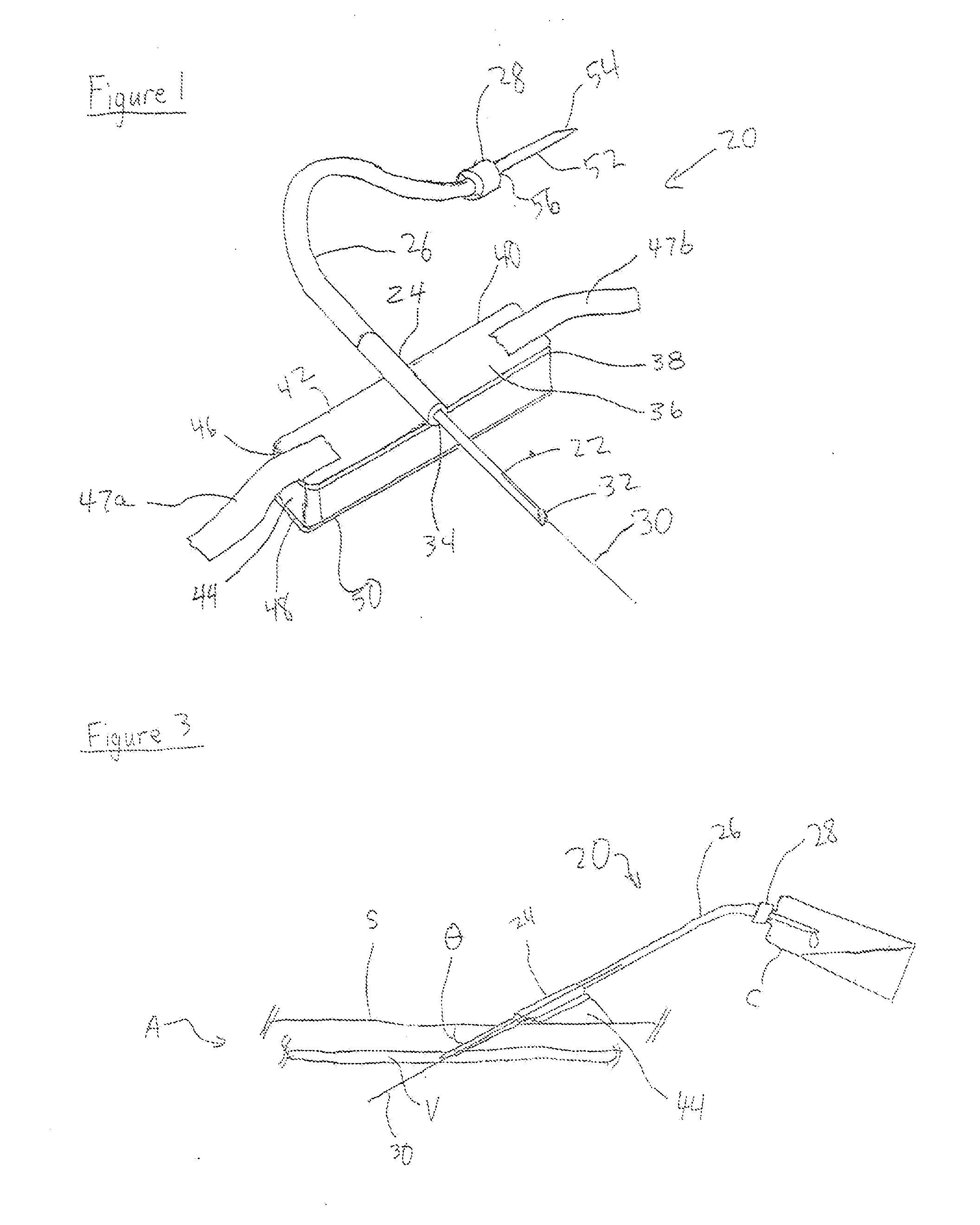 Butterfly needle assembly and method of use thereof