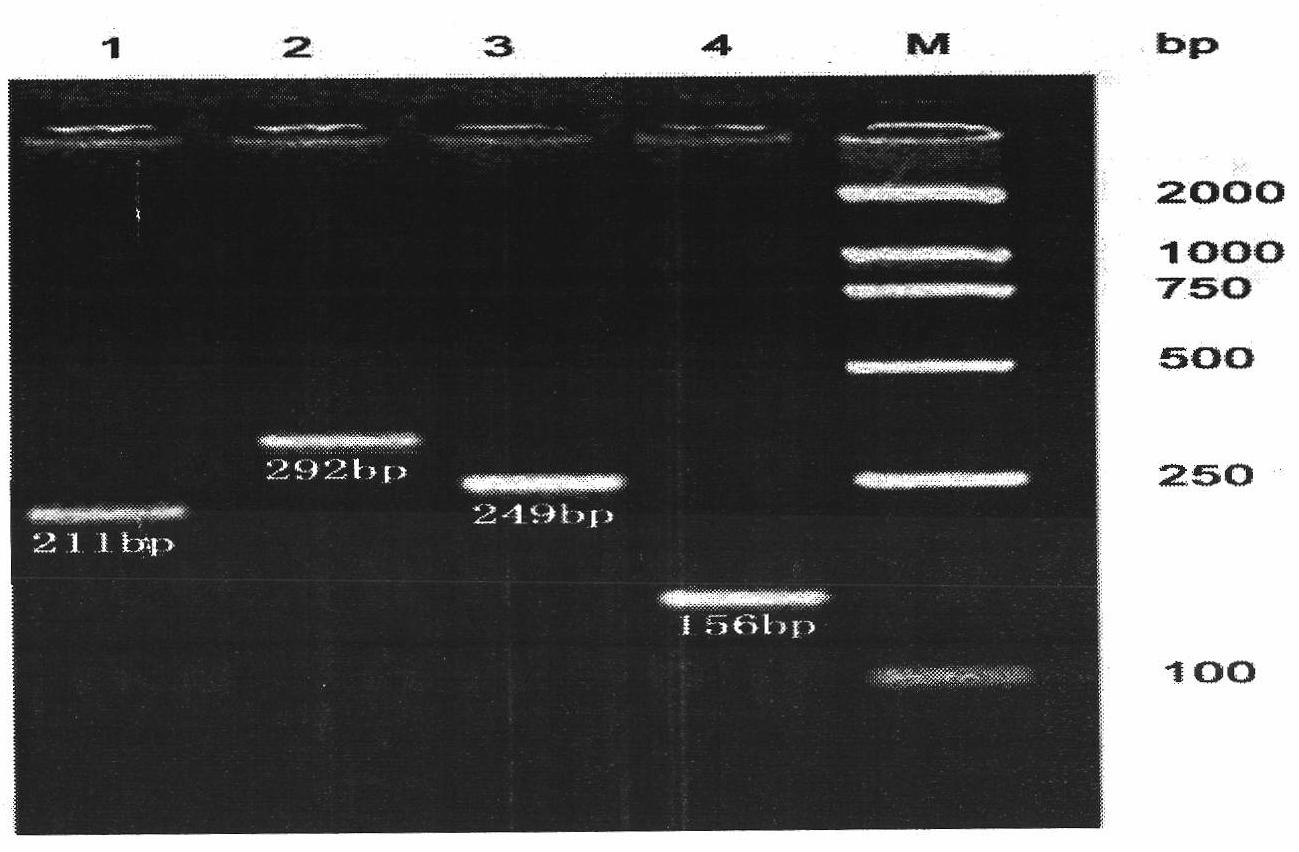Chip for detecting human DNA repair enzyme genetic polymorphism and preparation thereof
