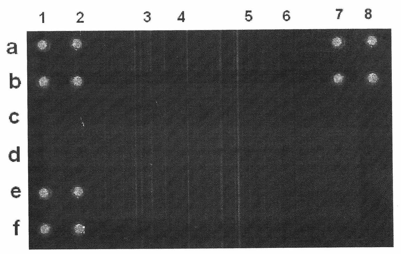 Chip for detecting human DNA repair enzyme genetic polymorphism and preparation thereof