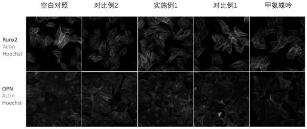 Bioglass hydrogel drug loading platform as well as preparation method and application thereof