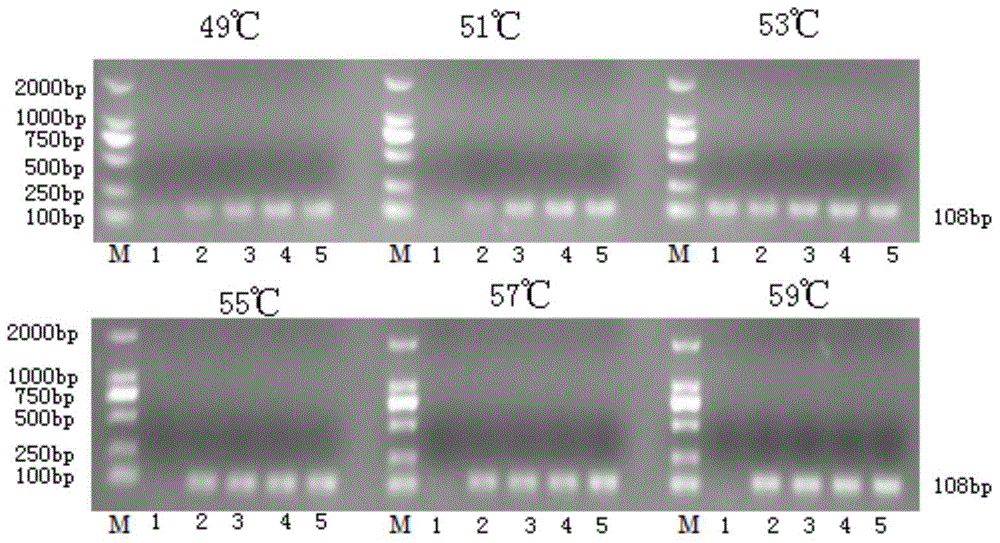 Primer for detecting Escherichia coli, and method and application of primer