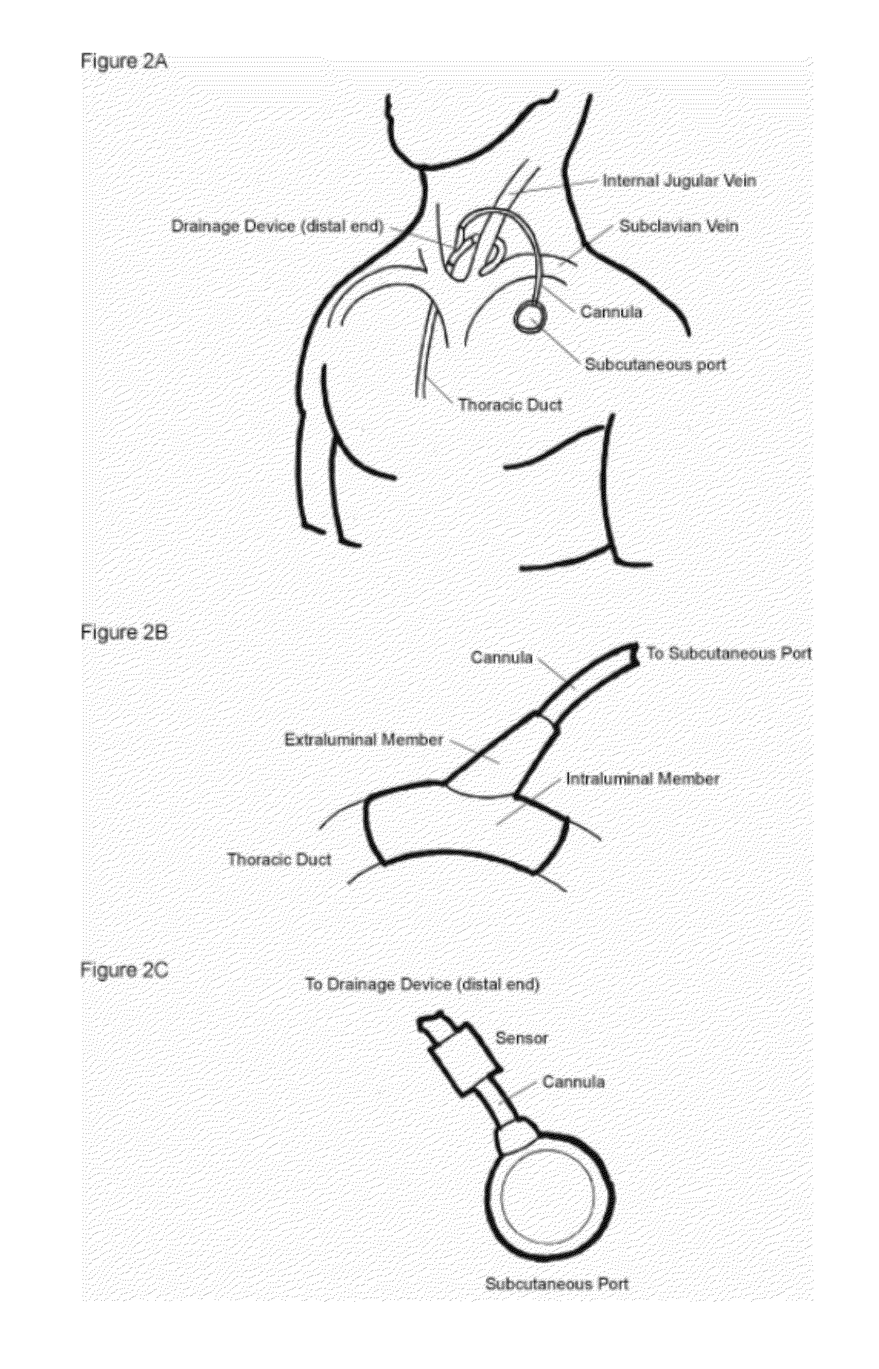 Drainage devices and methods for use