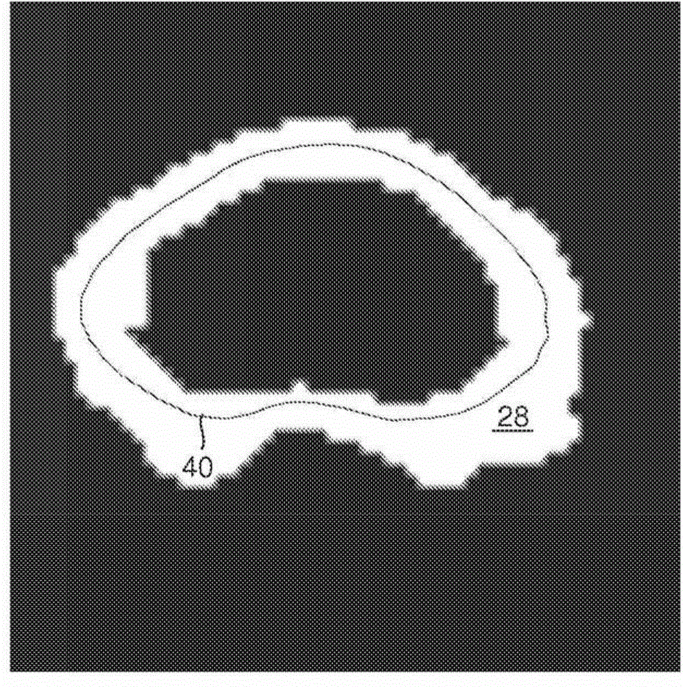 Probabilistic Refinement for Model-Based Segmentation