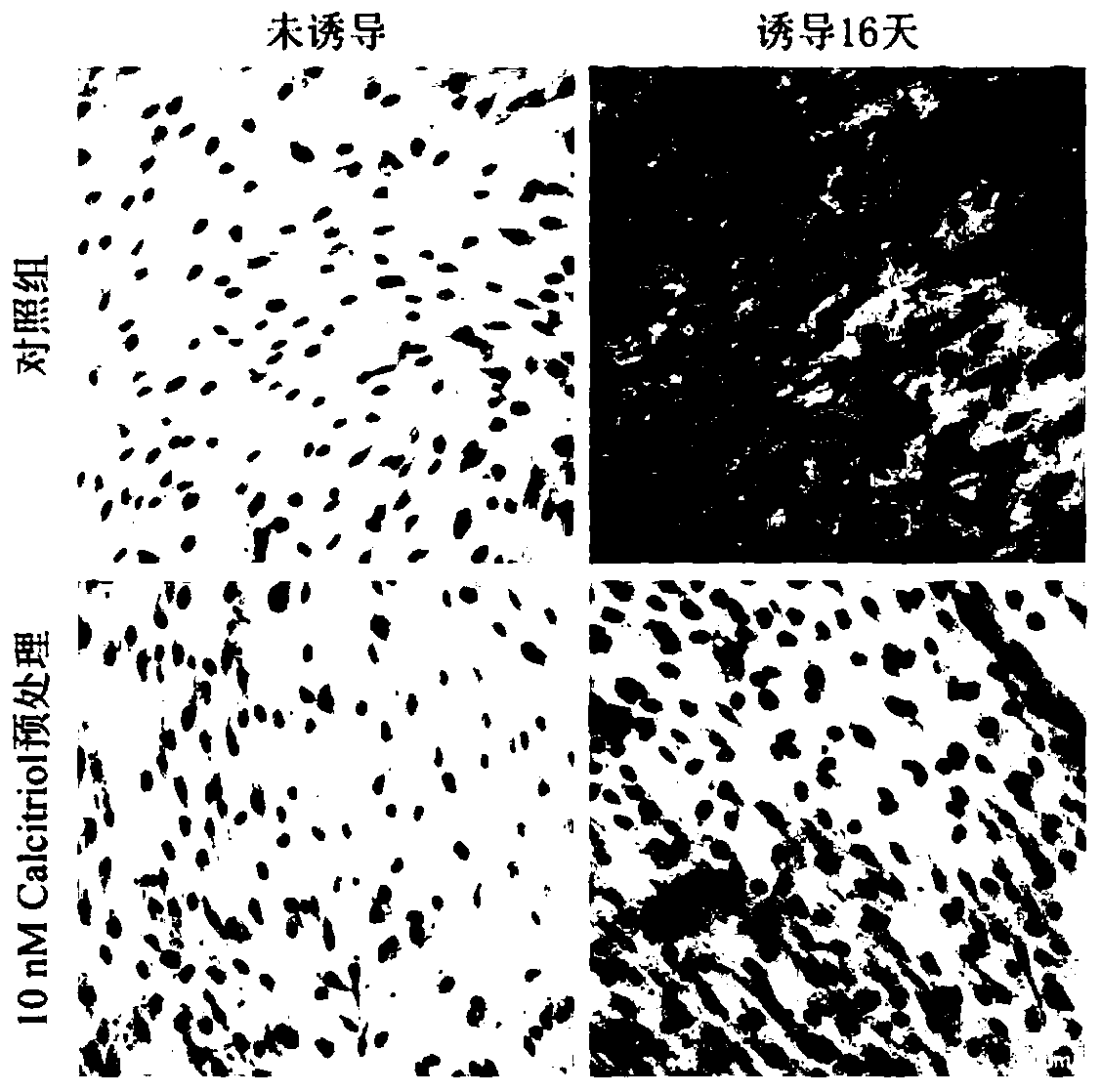 Application of vitamin D3 and analogues thereof in promoting differentiation of human skin fibroblasts into adipocytes