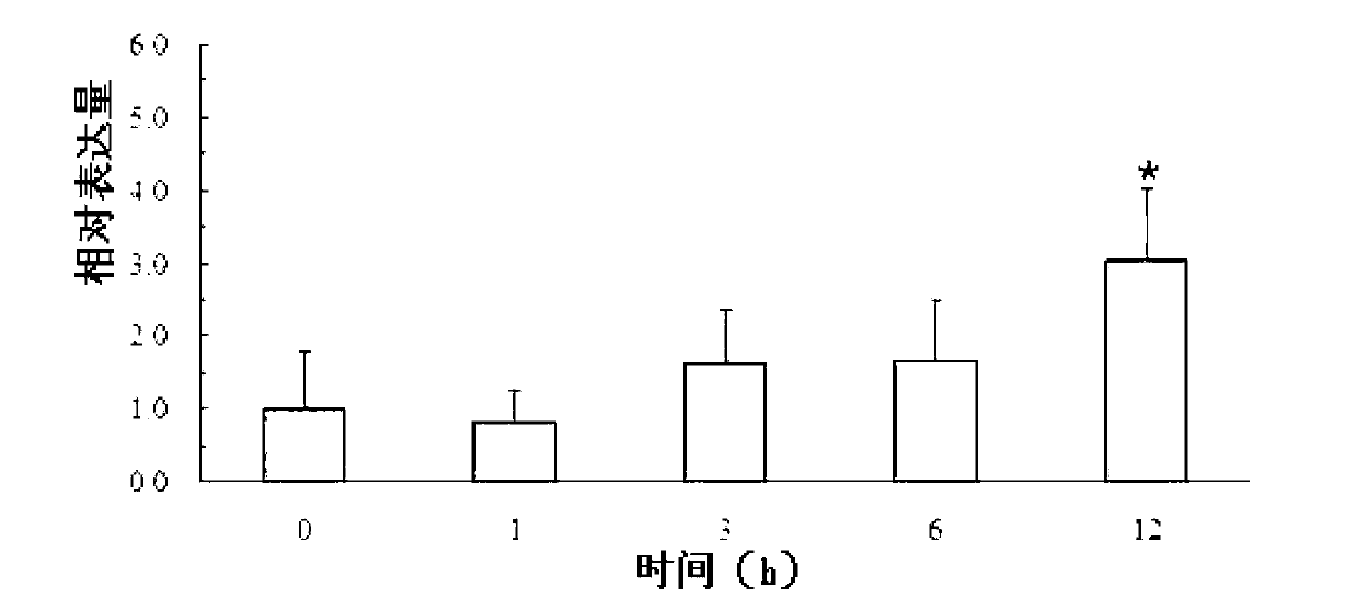 Soybean photosynthesis related gene GmDeg2 and application thereof