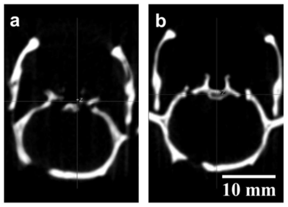 Composite flexible sio for bone repair  <sub>2</sub> -Elastic airgel scaffolds of cao fibers