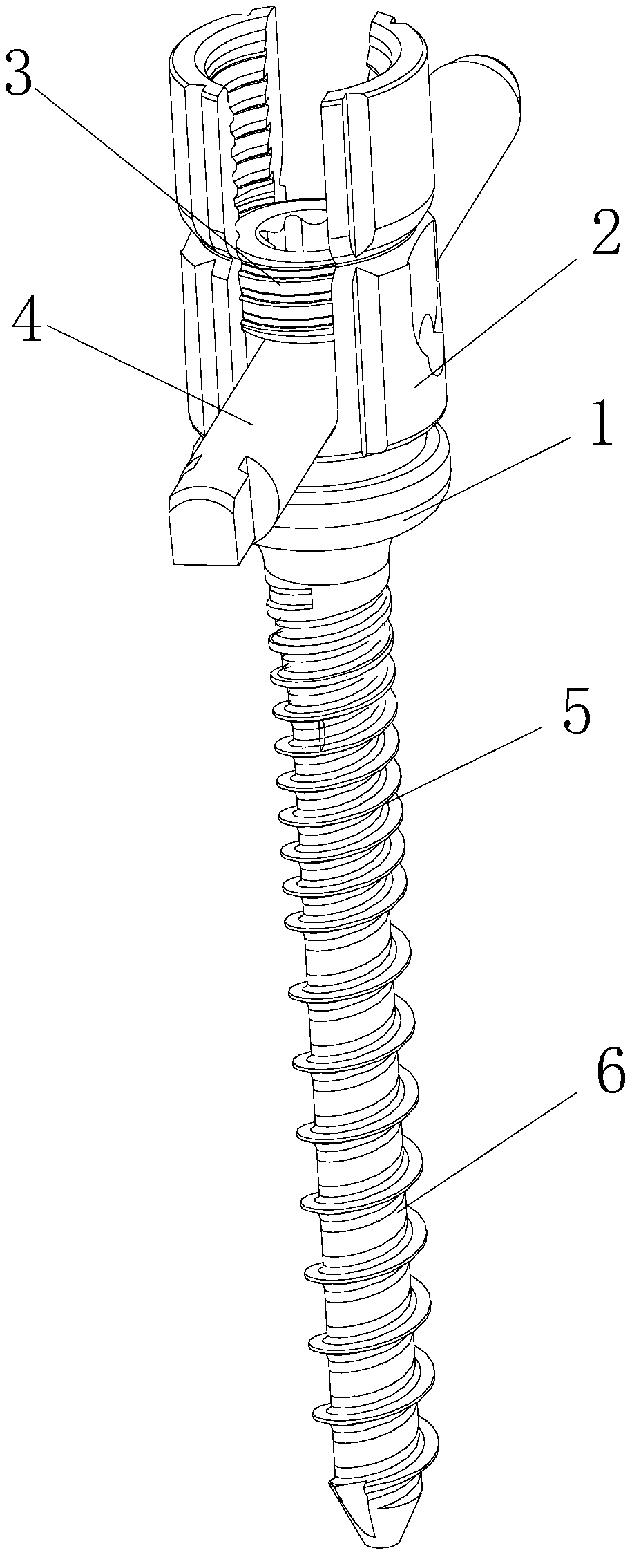 Minimally invasive spine universal and unidirectional integration pedicle screw feeding system