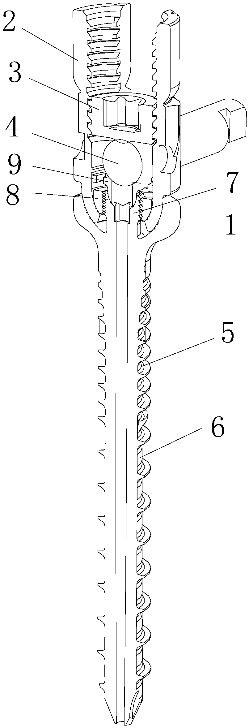 Minimally invasive spine universal and unidirectional integration pedicle screw feeding system