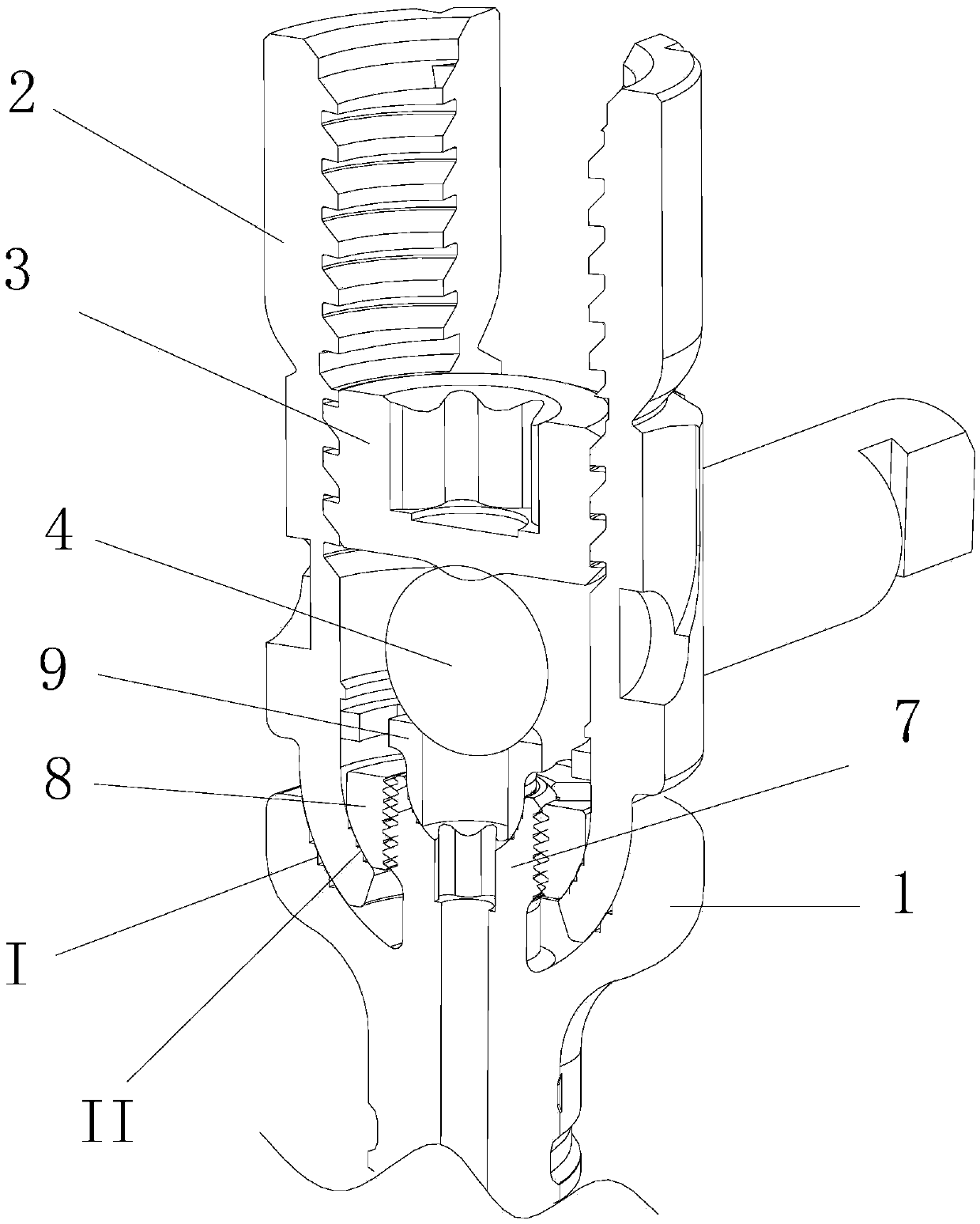 Minimally invasive spine universal and unidirectional integration pedicle screw feeding system