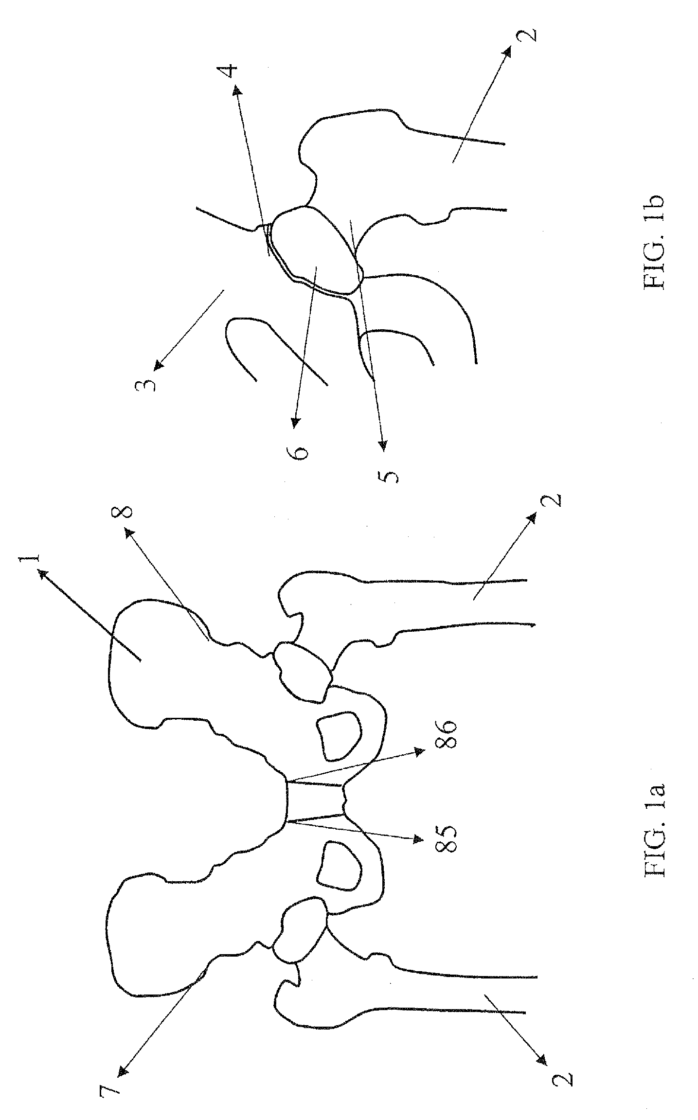 Joint placement methods and apparatuses