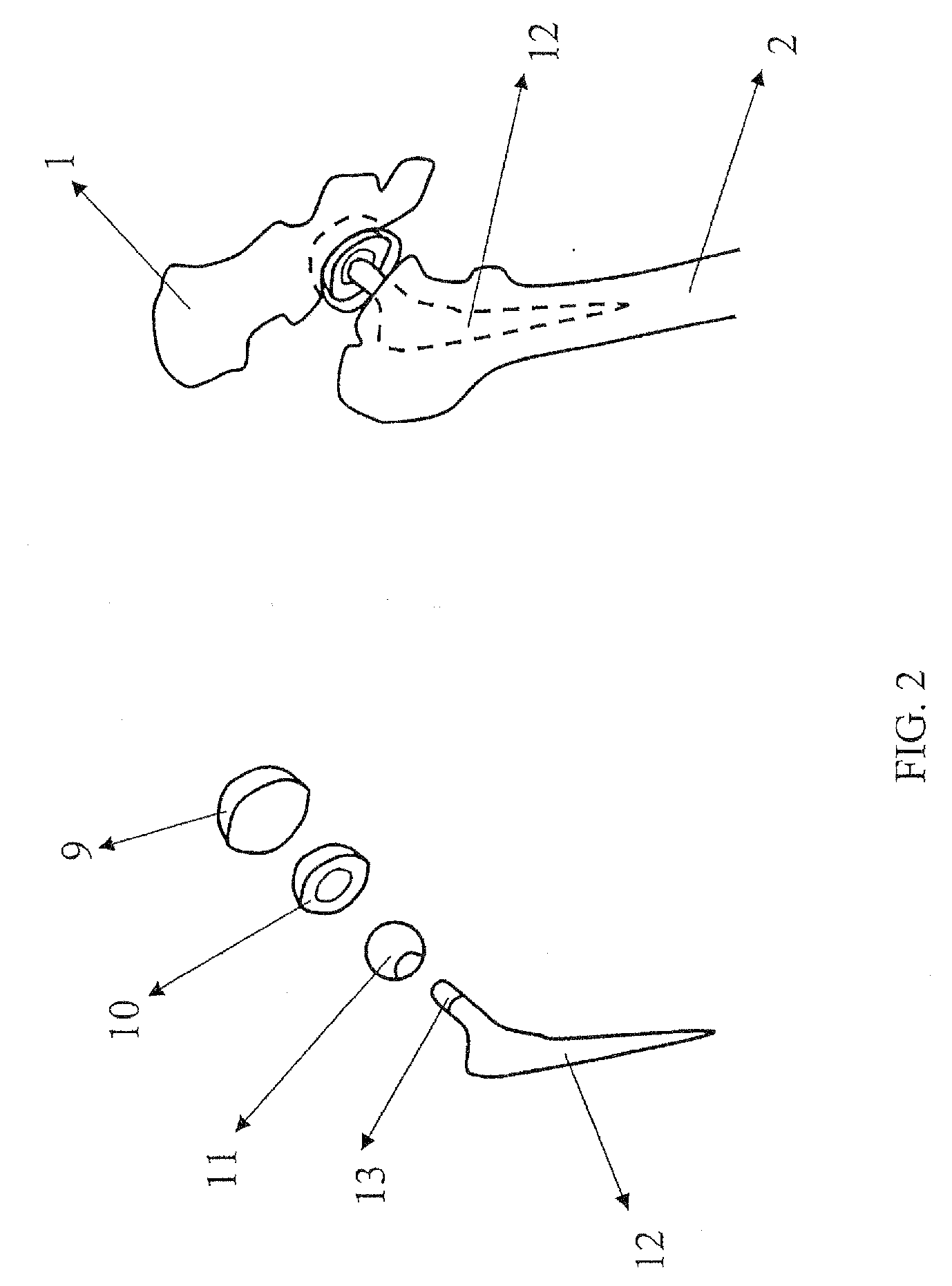 Joint placement methods and apparatuses