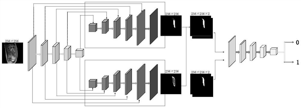 MR image placenta segmentation method of multi-task generative adversarial model