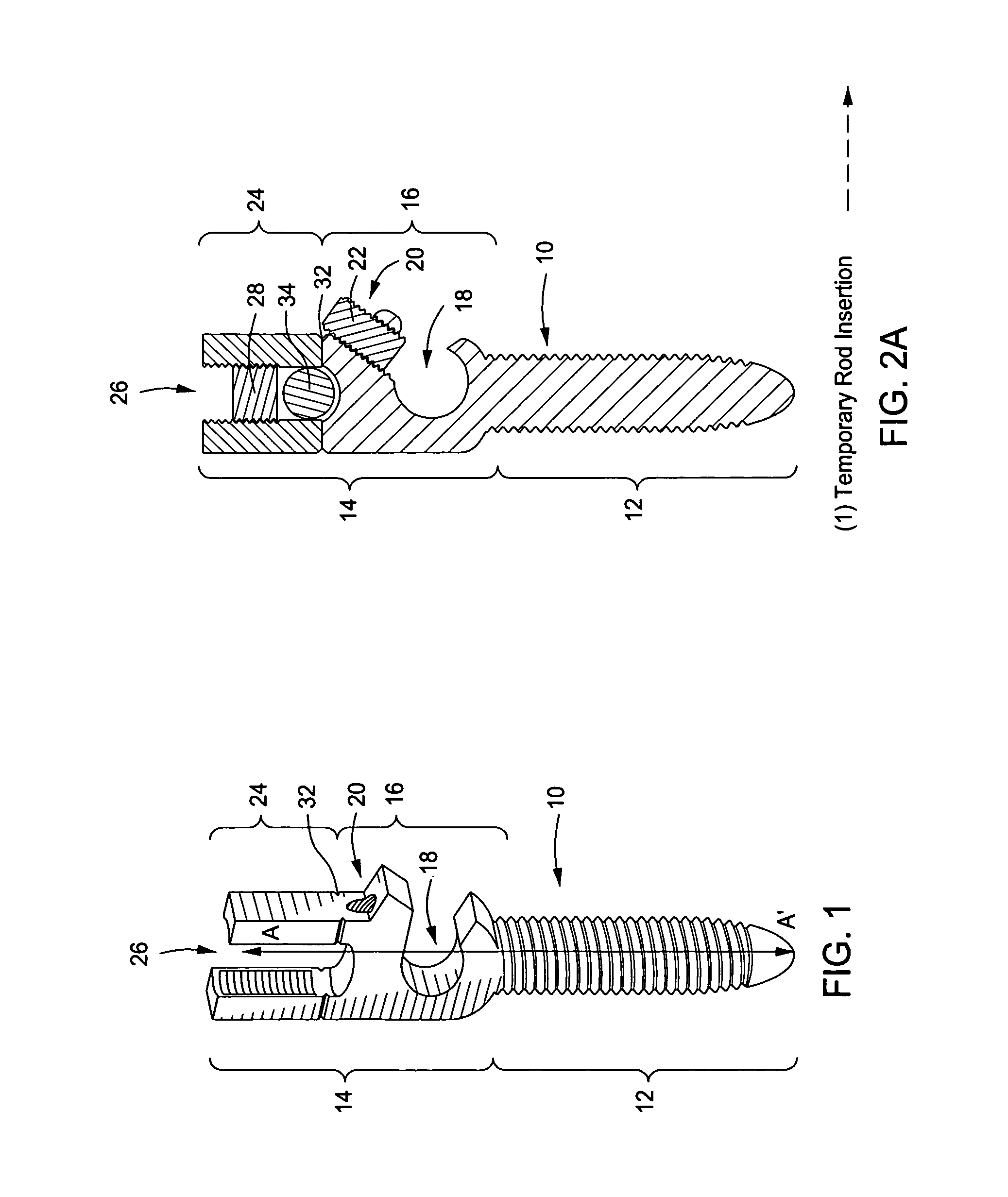 Pedicle screw