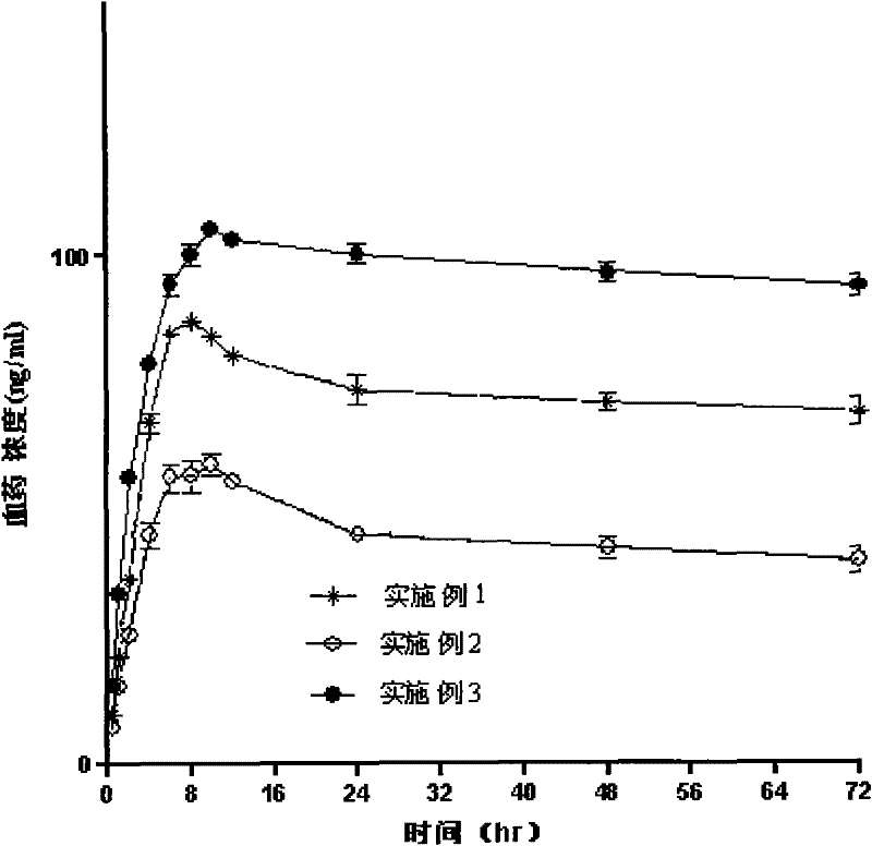 Transdermal medicament delivery system containing donepezil compound, preparation and preparation method