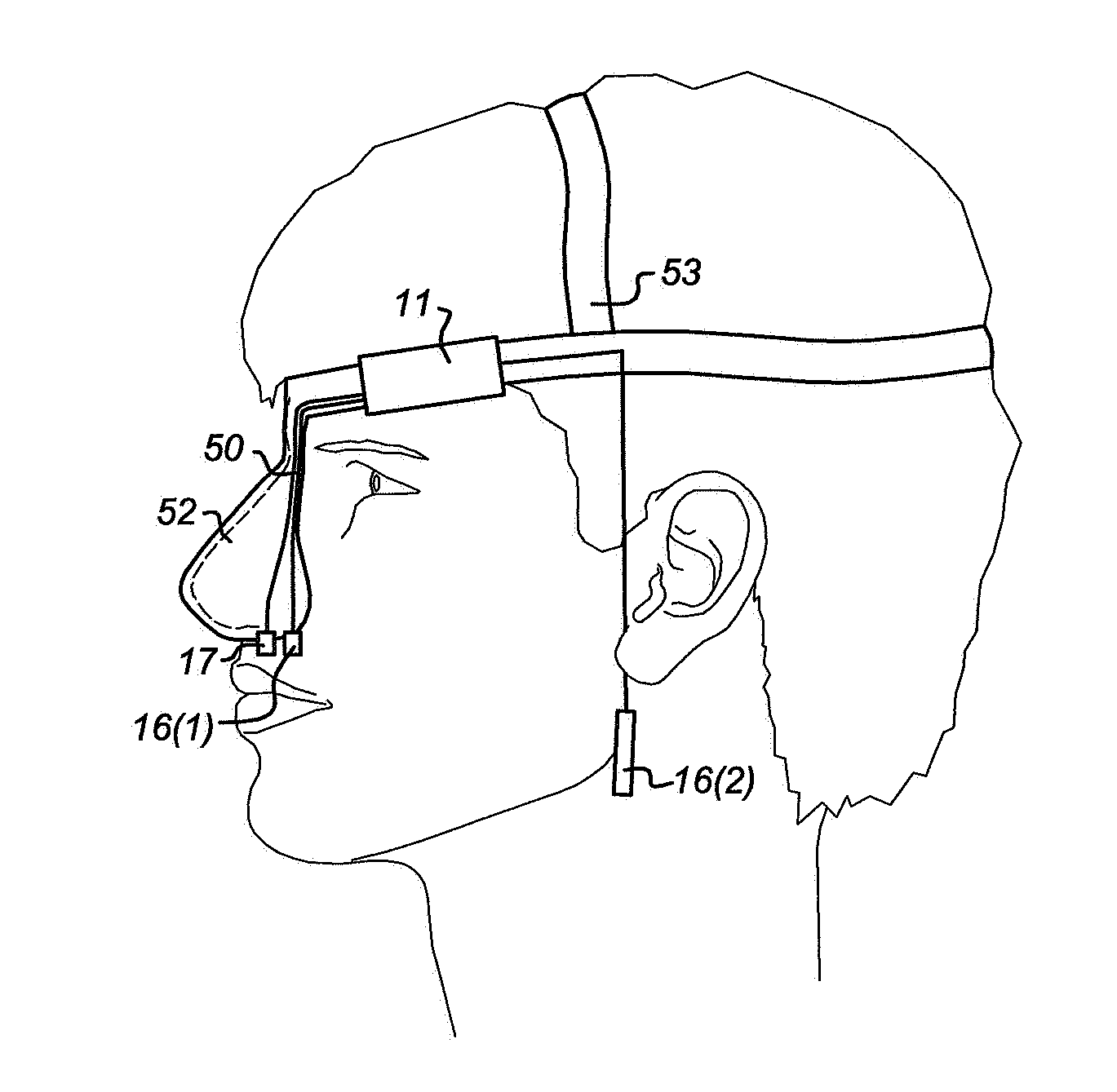 Nose stimulator for producing a stimulation signal to a nose